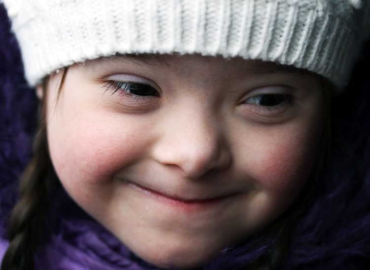 NUEVO: Científicos logran gran avance en la Investigación del Síndrome de Down