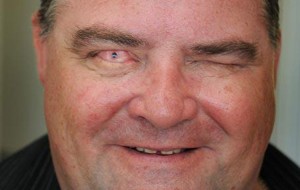 Bunnie Adams y Martin Jones, ciegos que ahora ven por un trasplante de dientes