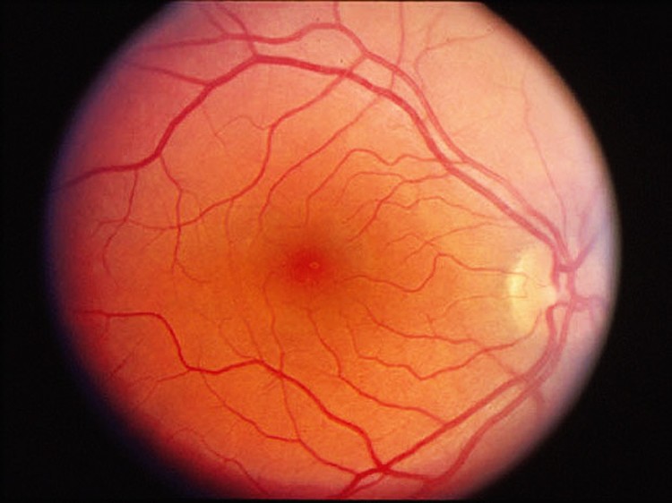Científicos transforman grasa en células progenitoras de la retina