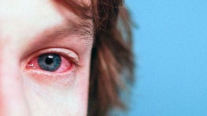 Los niños nacidos en Estados Unidos tienen un mayor riesgo de alergias