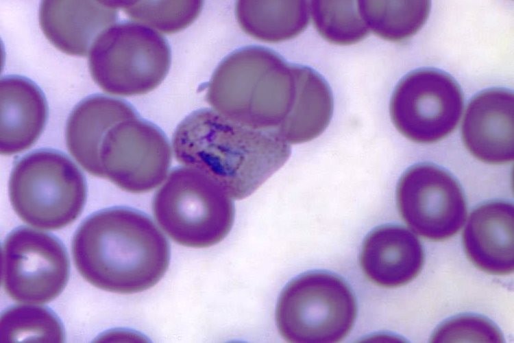 Vivax Malaria - Un parásito que está mutando -