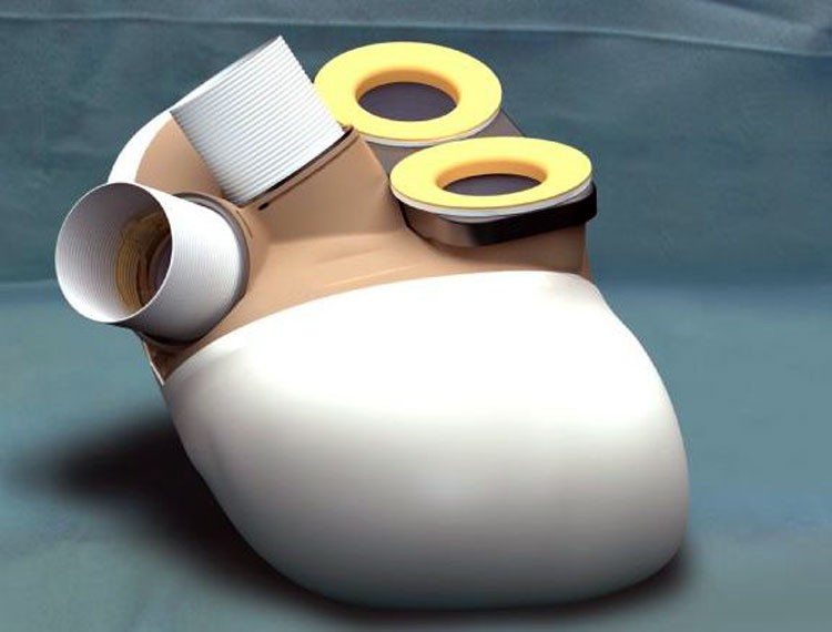 Carmat- El mejor corazón artificial del mundo