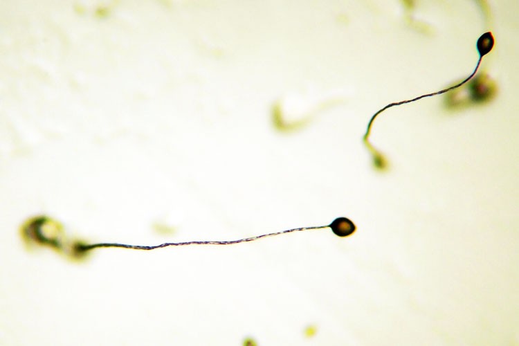 Ameba puede ayudar a combatir el Alzheimer