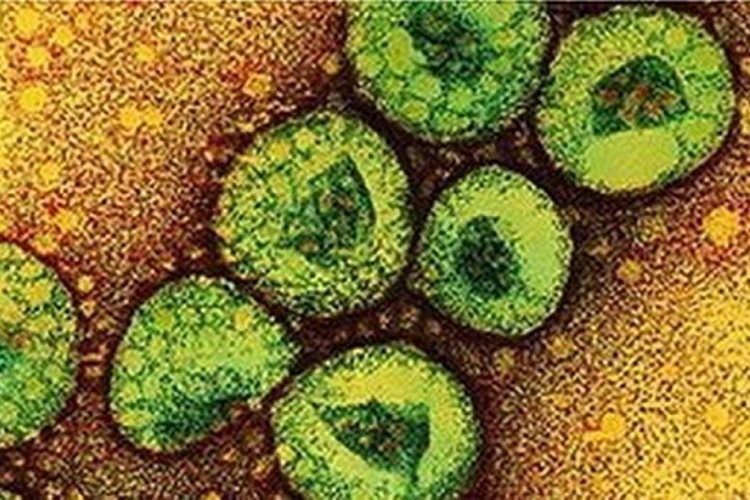 Preguntas frecuentes sobre el virus MERS