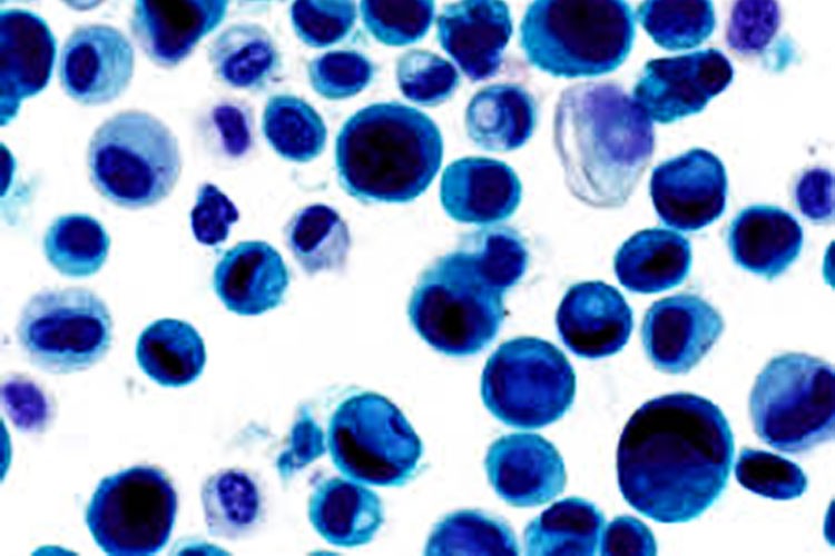 Laboratorio de “células raras” arroja luz sobre el Cáncer