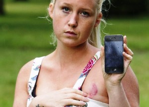 Joven se quema el pecho con su iPhone