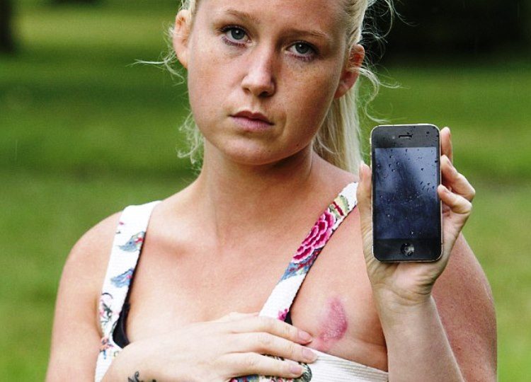 Joven se quema el pecho con su iPhone