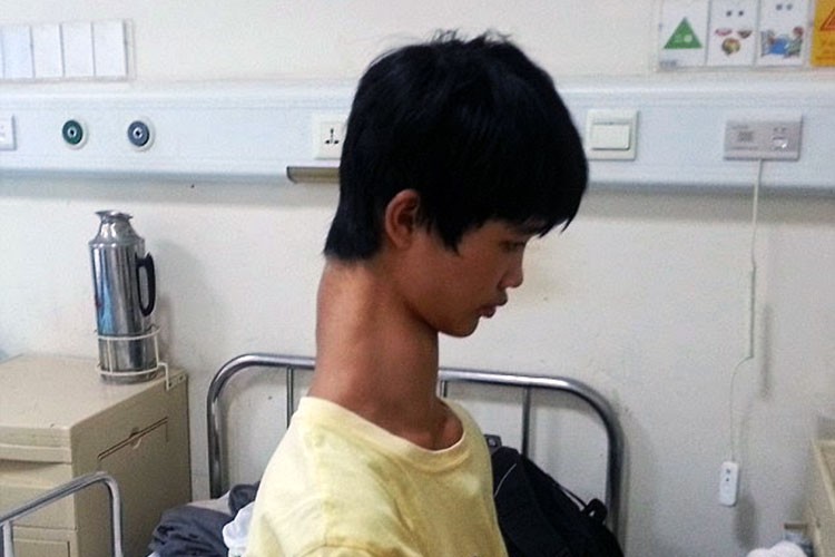 La persona con el cuello más largo del mundo