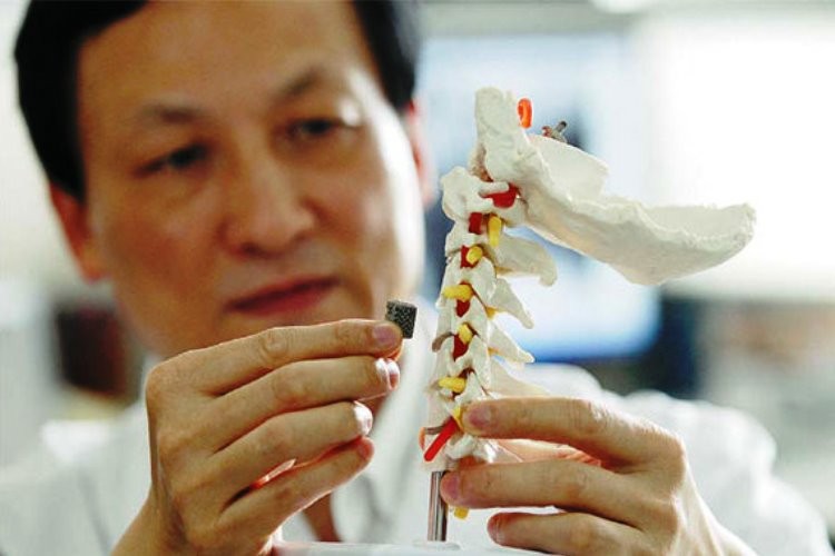 Primer implante médico con Impresión-3D en el mundo