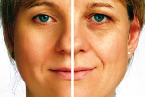 Botox, altamente eficaz en el Cáncer de estómago