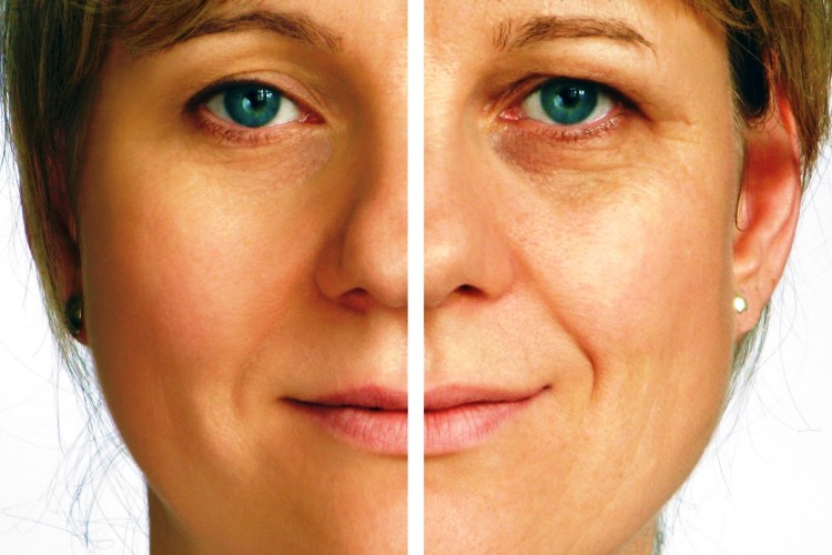 Botox, altamente eficaz en el Cáncer de estómago