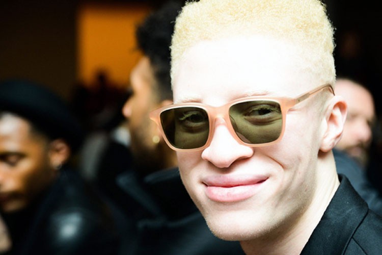 El riesgo de ser negro, rubio y con ojos azules