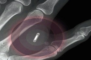 microchip en la mano