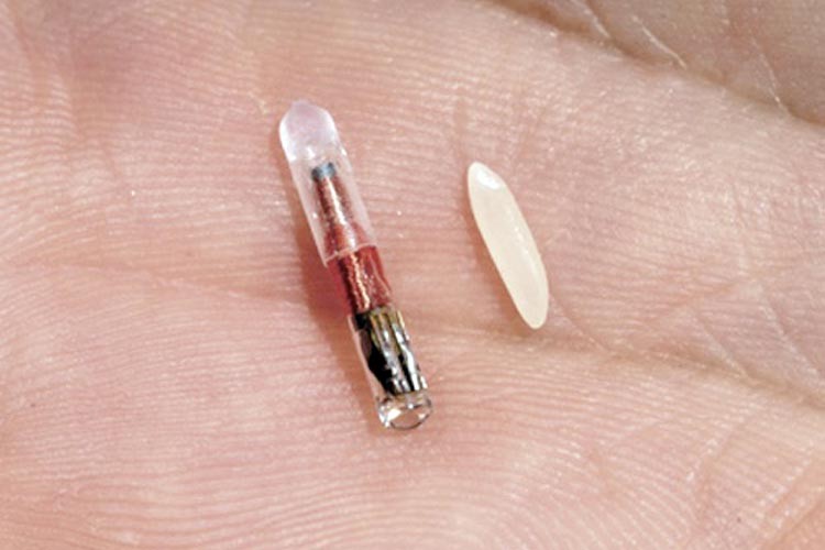 Advierten del uso de microchips en humanos