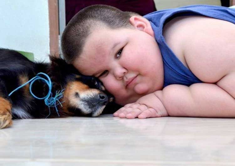 Niño de 3 años pesa 70kg