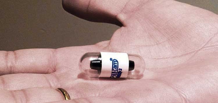 Viaje al interior del intestino delgado