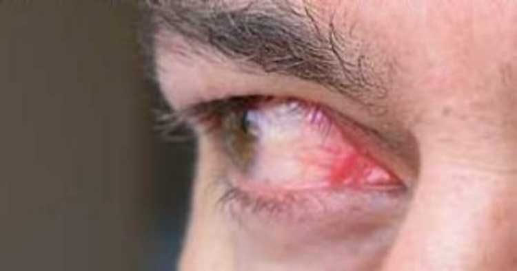 Efectos de la marihuana