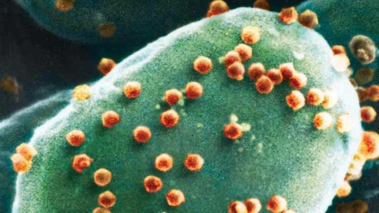 virus que causa la estupidez humana