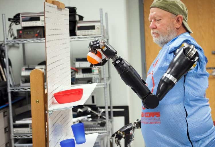 Amputado controla sus prótesis con la mente