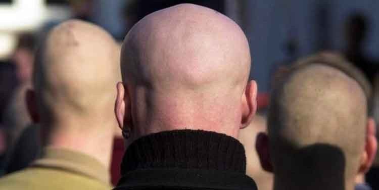 el pelo vuelva a crecer