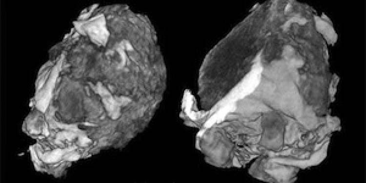 cristal con simetría prohibida