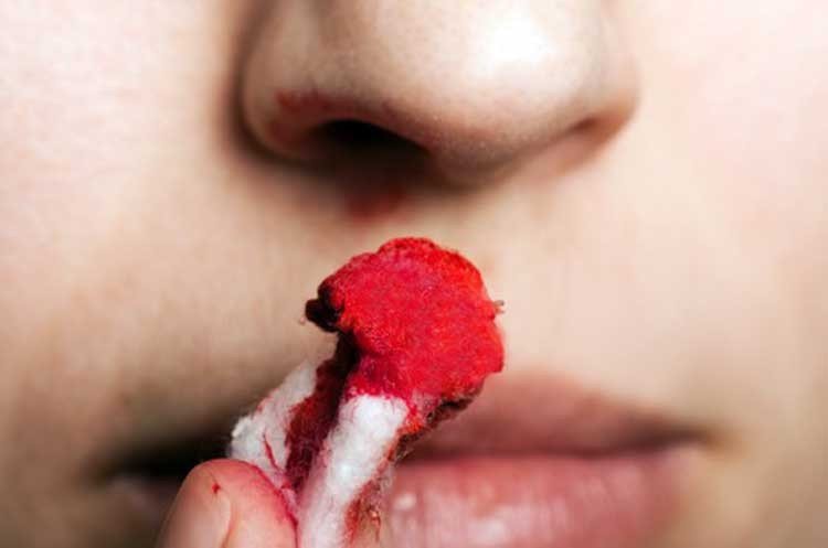 Sangre en la nariz