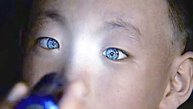 nino con ojos de gato