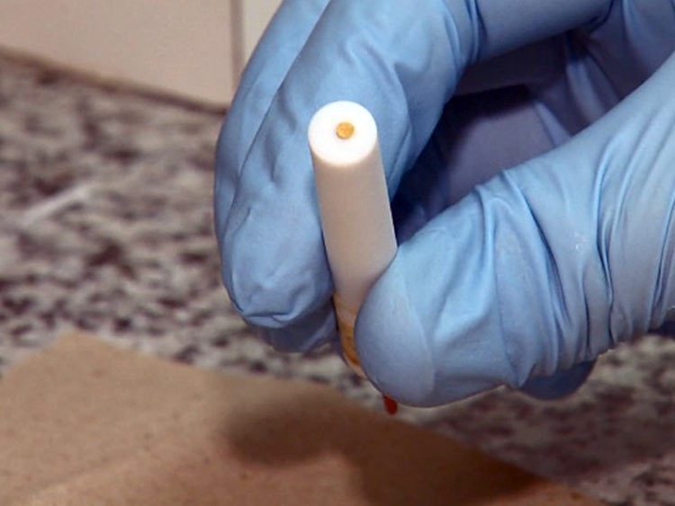 Crean sensor que detecta la predisposición al cáncer