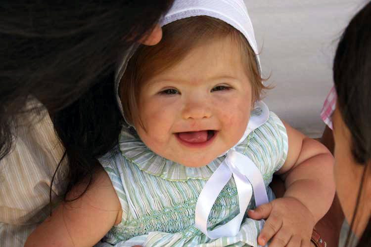 ONG quiere abortar bebés con síndrome de Down