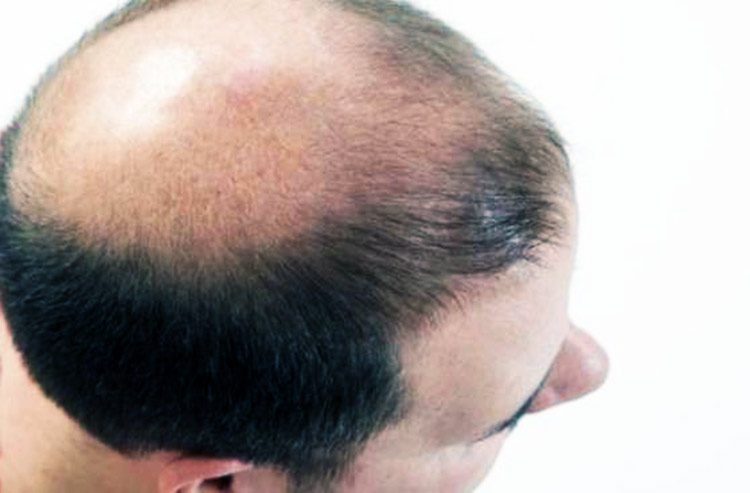 Verdaderamente soluciona arrugas y calvicie