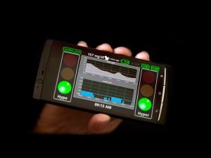 Páncreas artificial estaría disponible en dos años