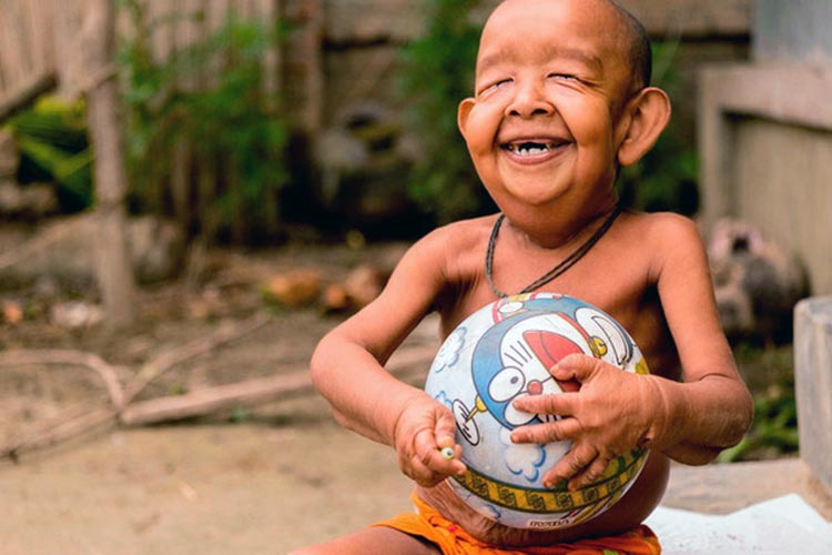 Tiene 4 años y parece tener 80