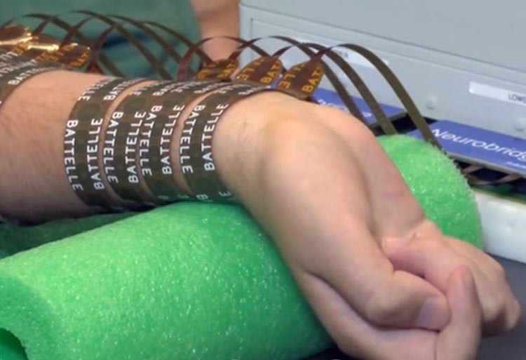 Ya hay personas Cyborgs