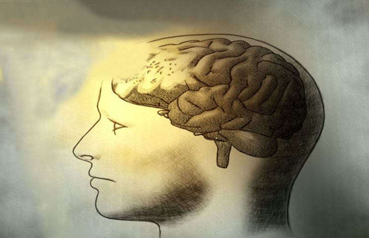 Ojo con el aluminio - Alzheimer y deterioro cognitivo