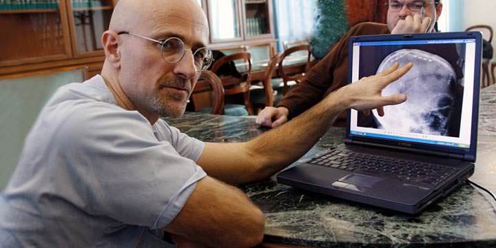 Médico italiano se prepara para trasplante de cabeza