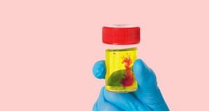 Tengo sangre en la Orina - 10 Causas de orinar con sangre