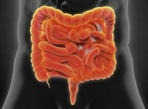 Qué sucede durante una Colonoscopia