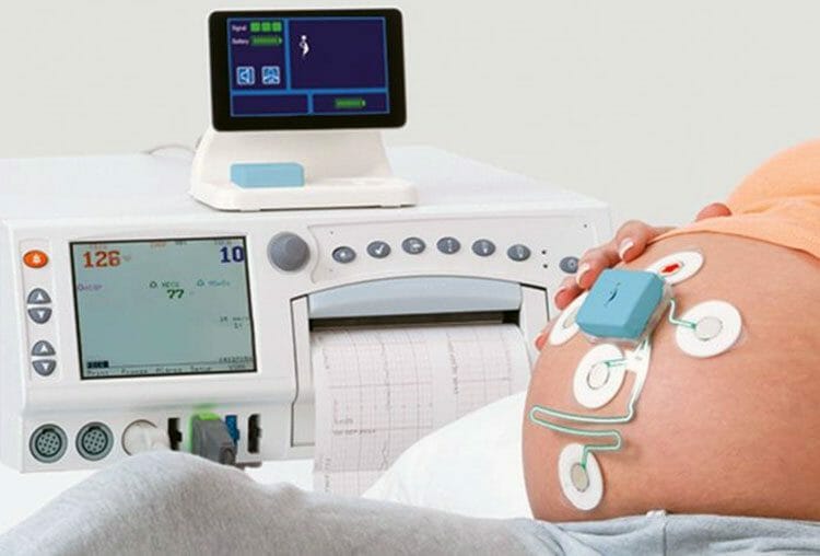 Latidos del bebé ¿Cuándo puedo escucharlos en casa?