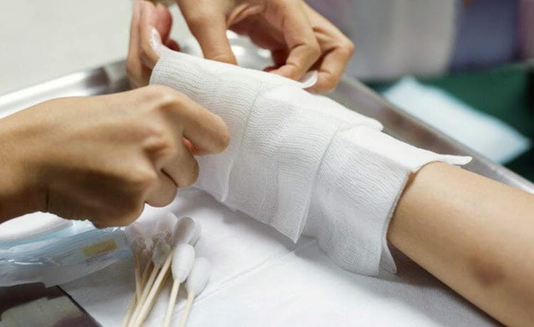 Impresora 3D portátil para heridas de la piel